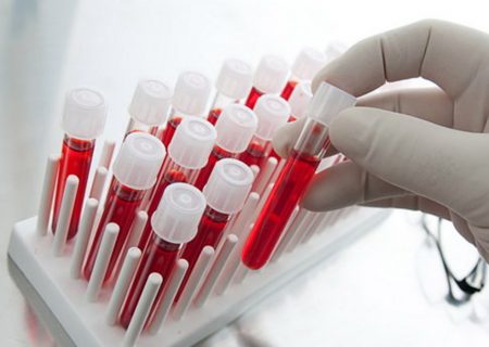 اهدای سلول های بنیادی جانی دوباره به بیماران می بخشد/ آمادگی انتقال خون البرز برای دریافت نمونه خون از داوطلبان