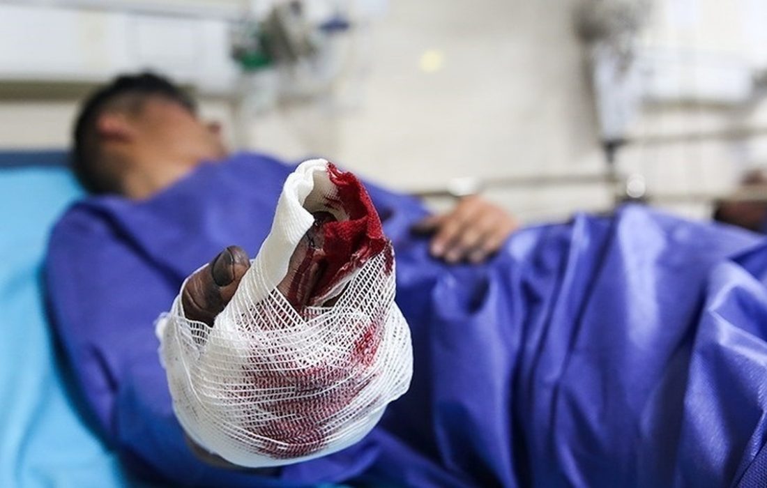 مصدومیت ۲۱۶ نفر در چهارشنبه سوری/ ۱۰ مورد قطع انگشت