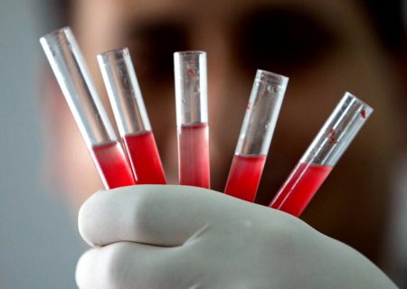 شناسایی یک گروه خونی نادر در استان کرمان