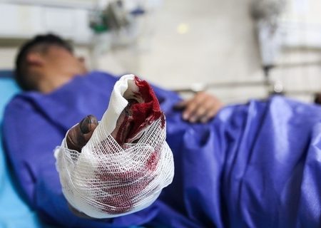 مصدومیت ۲۱۶ نفر در چهارشنبه سوری/ ۱۰ مورد قطع انگشت