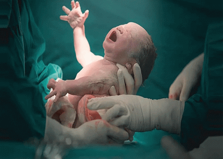 البرز رتبه دوم کشور در شاخص‌های بی دردی زایمان طبیعی