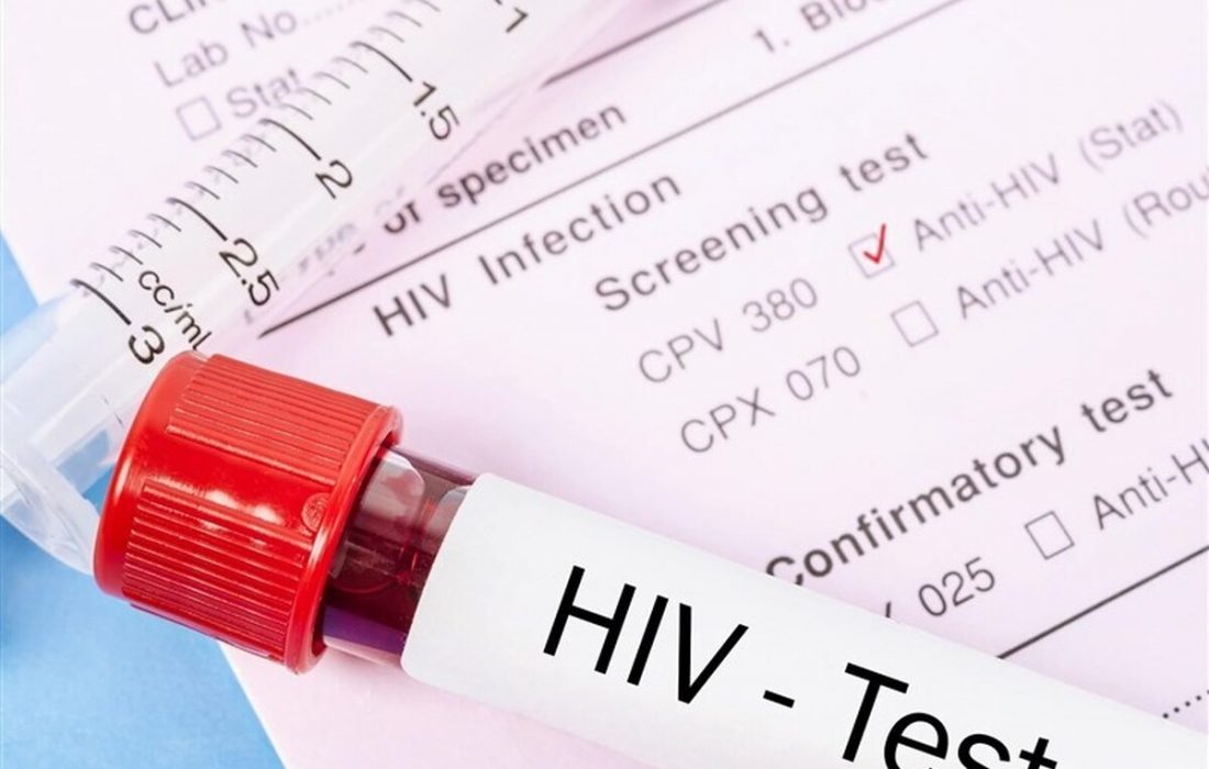 آغاز پویش ملی من هم تست HIV می دهم در البرز