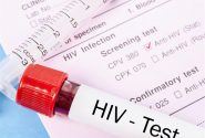 آغاز پویش ملی من هم تست HIV می دهم در البرز